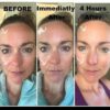 MARY KAY TimeWise Repair Lifting Bio-Cellulose Mask before and after
